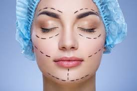 eye lift surgery cost