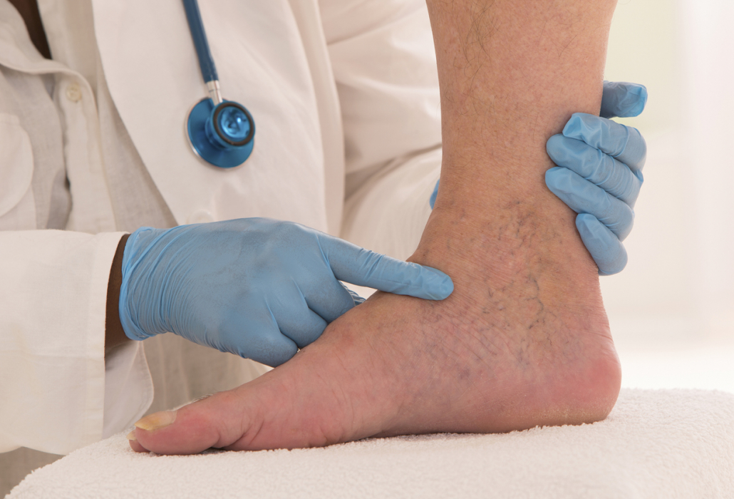 What is a vein clinic