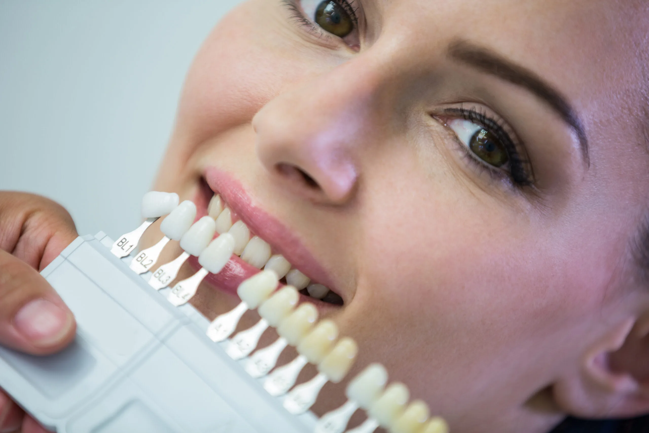 Affordable Dental Implants Houston tx