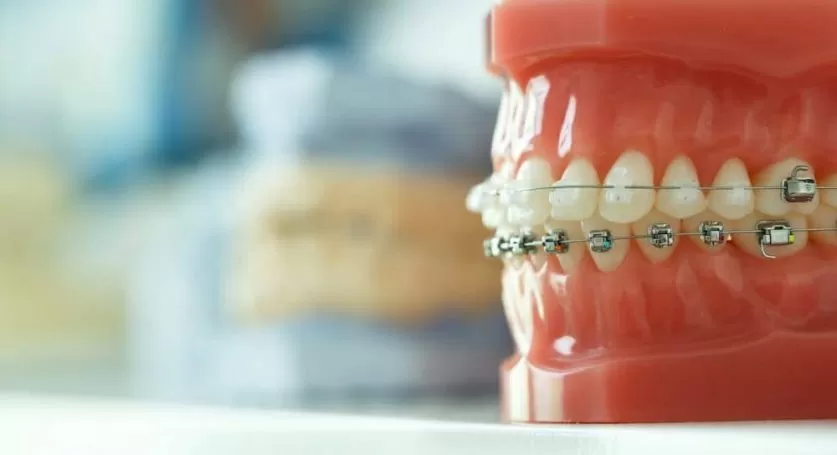 Best Orthodontist