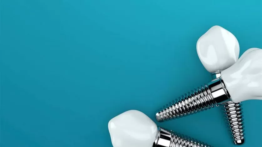 Dental Implants
