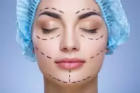 eye lift surgery cost