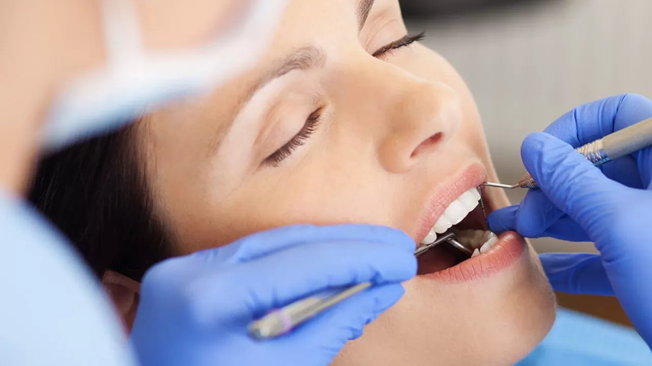 teeth cleaning houston tx