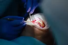 Oral Surgery Near Me