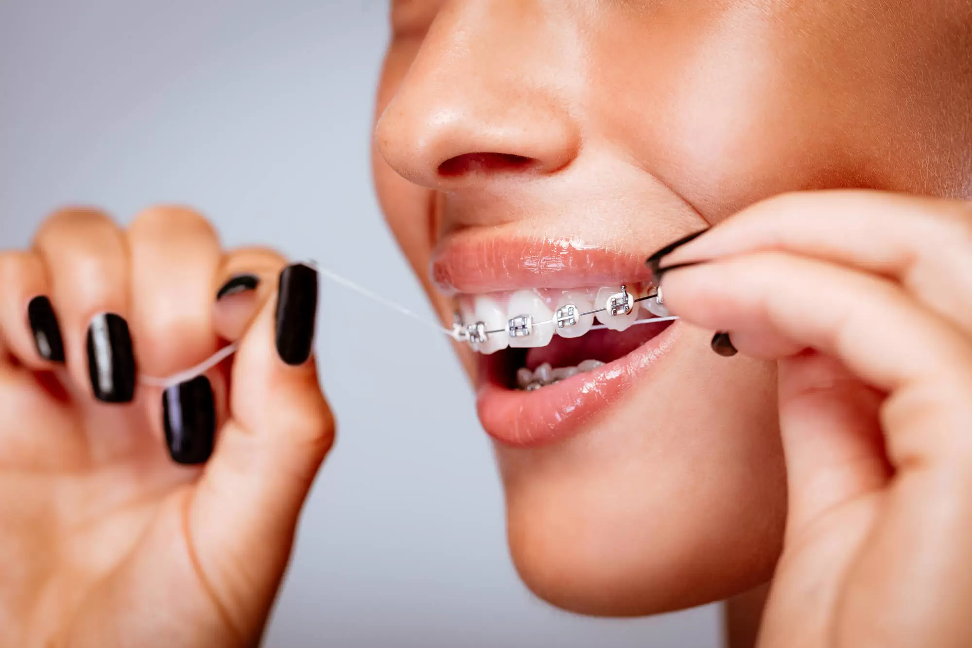 orthodontist Hollywood