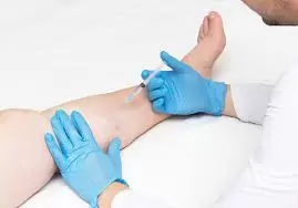 what do vein centers do